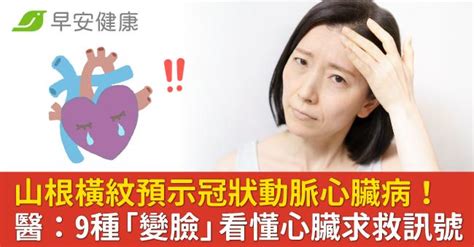 山根橫紋醫美|臉上4種皺紋出現、心肌梗塞風險增！醫：尤其「抬頭。